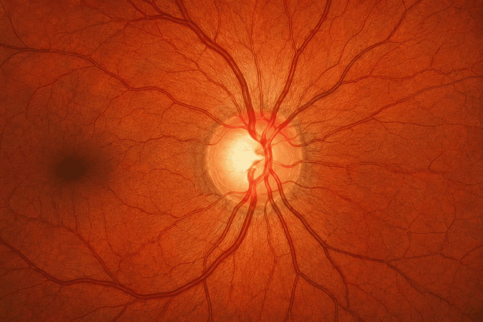 Close-up view of the optic nerve head illustrating the area assessed for glaucomatous change